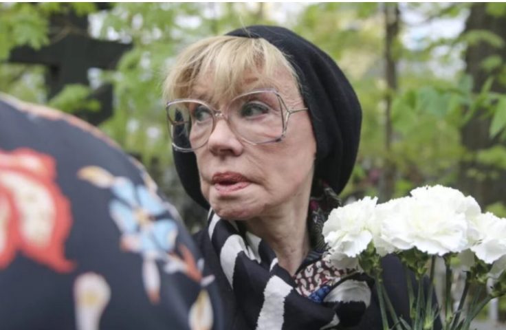 "Сморщенная стала": недоброжелатели осудили внешний вид изменившейся Алентовой